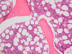 Robust tissue adhesion with H&E stain of bone marrow trephine (BMT) biopsy section on Trajan Series 3 adhesive microscope slide.