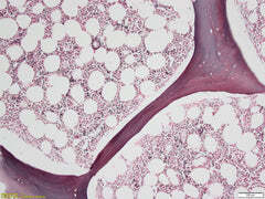 Minimal background staining with the reticulin silver stain of bone marrow trephine (BMT) biopsy section on Trajan Series 3 adhesive microscope slide.